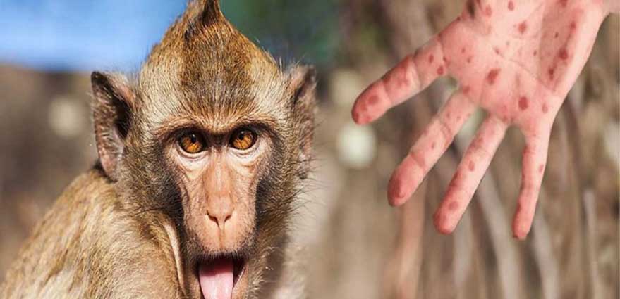 عکس ویروس آبله میمونش